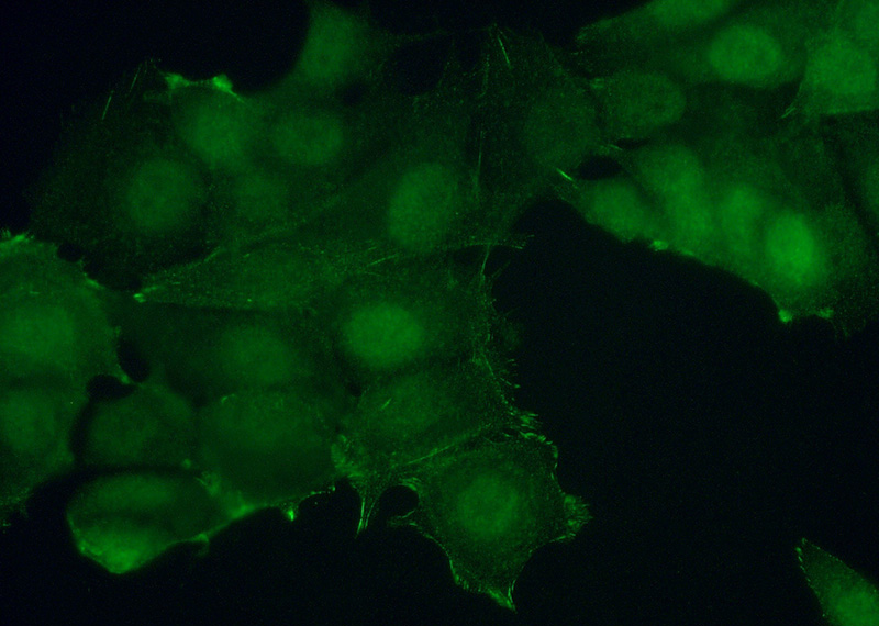 Immunofluorescent analysis of (10% Formaldehyde) fixed MCF-7 cells using Catalog No:115036(RPS6KB2 Antibody) at dilution of 1:50 and Alexa Fluor 488-congugated AffiniPure Goat Anti-Rabbit IgG(H+L)