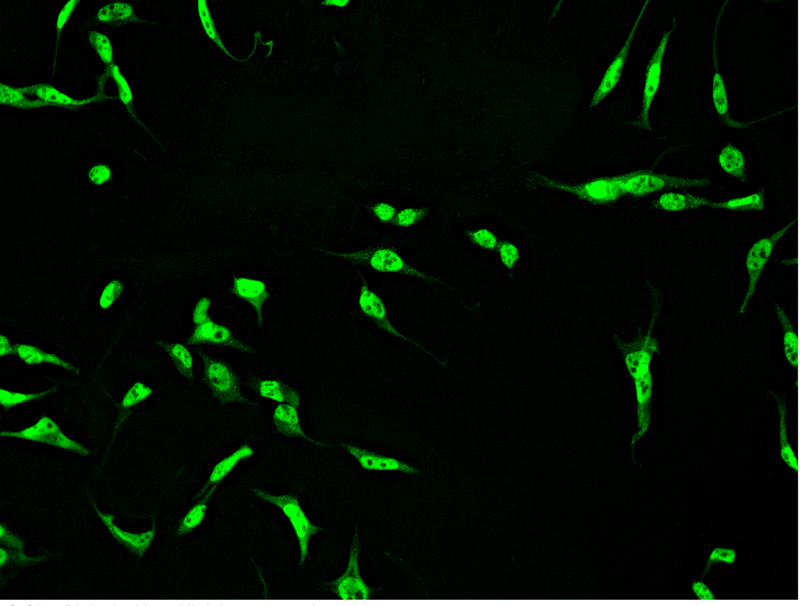 Human CTBP1 Immunofluorescence(IF) 15158