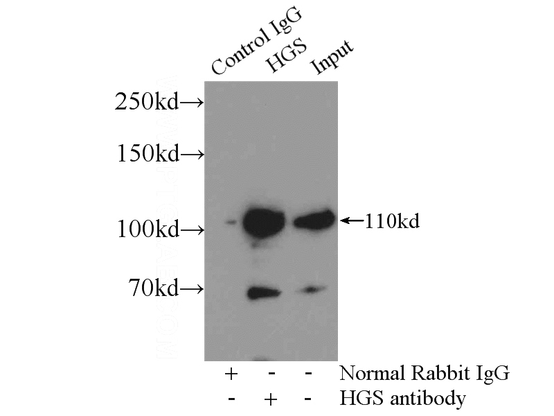 IP Result of anti-HGS (IP:Catalog No:111314, 5ug; Detection:Catalog No:111314 1:1000) with mouse brain tissue lysate 3000ug.