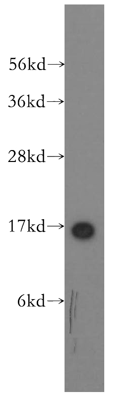 mouse thymus tissue were subjected to SDS PAGE followed by western blot with Catalog No:115178(SH2D1A antibody) at dilution of 1:500