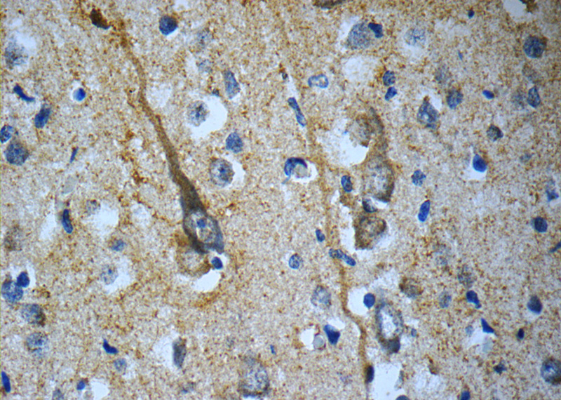 Immunohistochemistry of paraffin-embedded human brain slide using Catalog No:115972(TACR3 Antibody) at dilution of 1:50