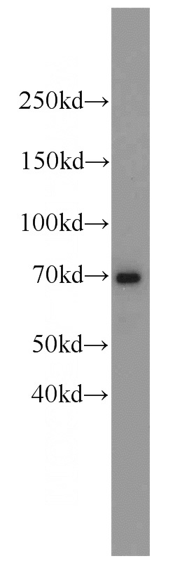 mouse heart tissue were subjected to SDS PAGE followed by western blot with Catalog No:108051(ANGPT1 antibody) at dilution of 1:1000