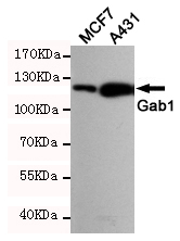 Western blot analysis of extracts from A431 and MCF7 cells using Gab1 (Ab-627) rabbit pAb (1:1000 diluted).Predicted band size:110KDa.Observed band size:110KDa.