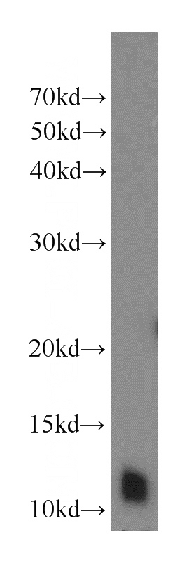 mouse testis tissue were subjected to SDS PAGE followed by western blot with Catalog No:109955(DNAL4 antibody) at dilution of 1:300