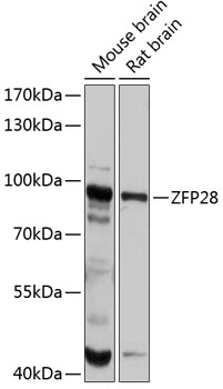 Western blot - ZFP28 Polyclonal Antibody 
