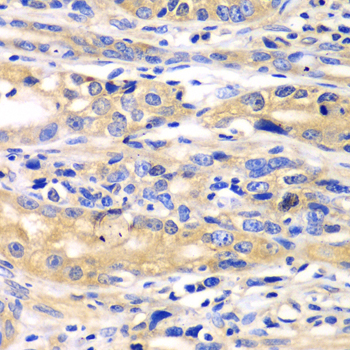 Immunohistochemistry - SARS Polyclonal Antibody 