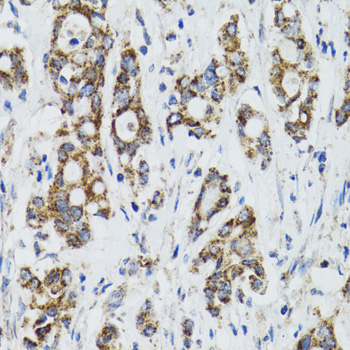 Immunohistochemistry - SURF1 Polyclonal Antibody 