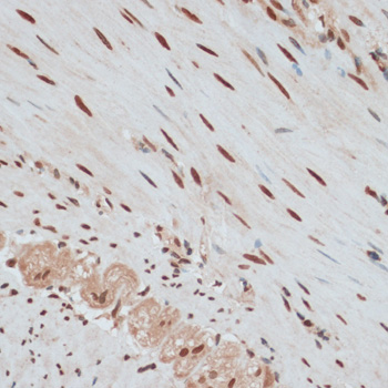 Immunohistochemistry - ZNF574 Polyclonal Antibody 