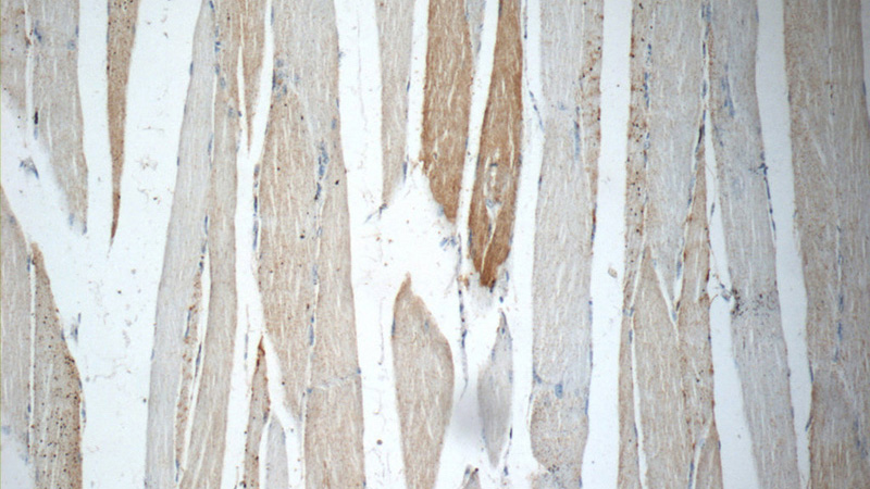 Immunohistochemistry of paraffin-embedded human skeletal muscle slide using Catalog No:113122(NEURL2 Antibody) at dilution of 1:50