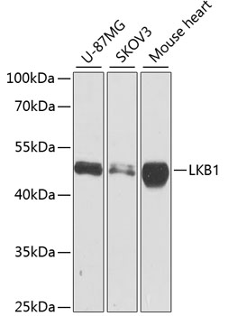 Western blot - LKB1 Polyclonal Antibody 
