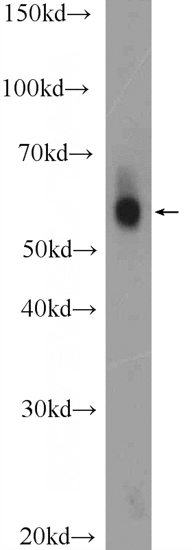 HepG2 cells were subjected to SDS PAGE followed by western blot with Catalog No:114288(PSAP Antibody) at dilution of 1:600