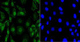 Fig2: Immunocytochemical staining of SH-SY-5Y cells using anti-EFTUD2 Mouse mAb