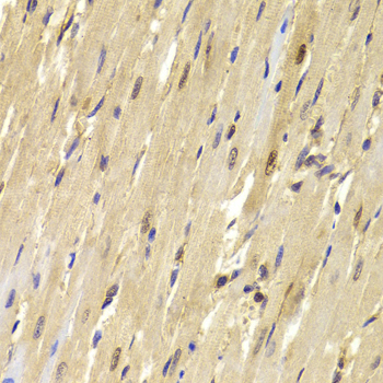 Immunohistochemistry - TOPBP1 Polyclonal Antibody 