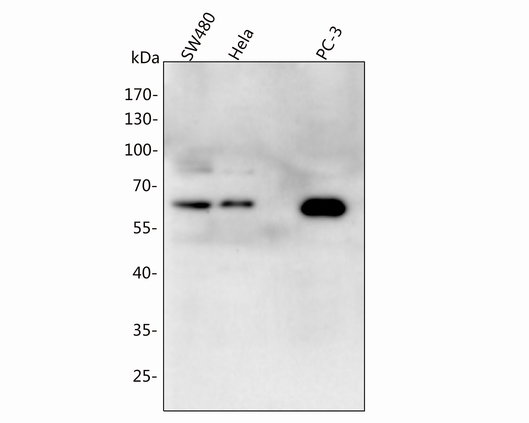 Fig1:; Western blot analysis of OC-3 on different lysates. Proteins were transferred to a PVDF membrane and blocked with 5% NFDM/TBST for 1 hour at room temperature. The primary antibody ( 1/500) was used in 5% NFDM/TBST at room temperature for 2 hours. Goat Anti-Rabbit IgG - HRP Secondary Antibody (HA1001) at 1:40,000 dilution was used for 1 hour at room temperature.; Positive control:; Lane 1: SW480 cell lysate; Lane 2: Hela cell lysate; Lane 3: PC-3 cell lysate; Predicted band size: 50 kDa; Observed band size: 60 kDa