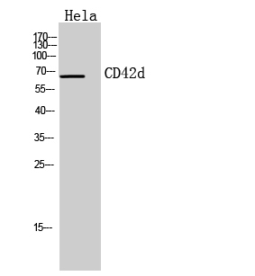 Fig1:; Western Blot analysis of Hela cells using CD42d Polyclonal Antibody.. Secondary antibody（catalog#: HA1001) was diluted at 1:20000