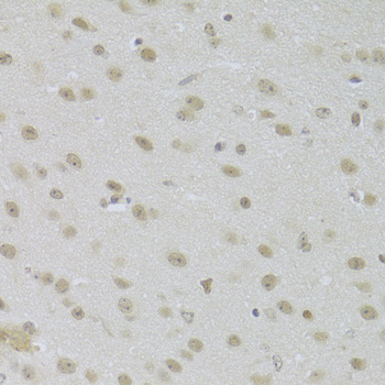 Immunohistochemistry - JMJD6 Polyclonal Antibody 