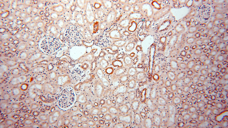 Immunohistochemical of paraffin-embedded human kidney using Catalog No:113060(NDUFA4L2 antibody) at dilution of 1:100 (under 10x lens)