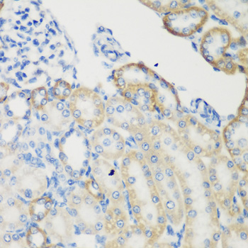 Immunohistochemistry - TGM5 Polyclonal Antibody 