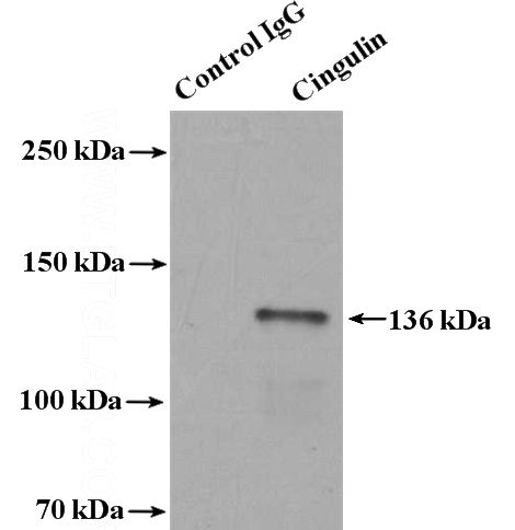 IP Result of anti-CGN (IP:Catalog No:109317, 4ug; Detection:Catalog No:109317 1:800) with mouse kidney tissue lysate 4800ug.