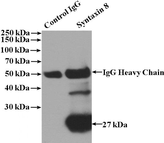 IP Result of anti-STX8 (IP:Catalog No:115801, 4ug; Detection:Catalog No:115801 1:500) with A375 cells lysate 3600ug.