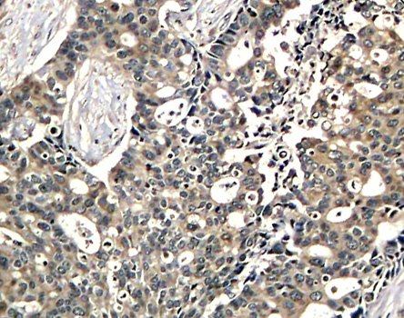 Immunohistochemistry - Phospho-DOK2-Y299 pAb 