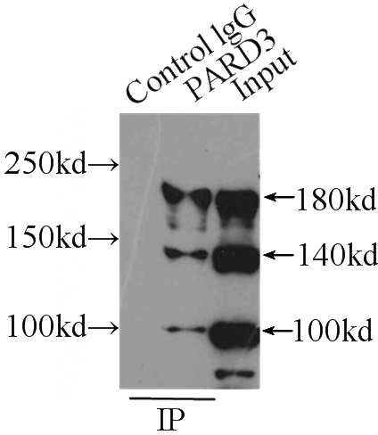 IP Result of anti-PARD3 (IP:Catalog No:113582, 4ug; Detection:Catalog No:113582 1:200) with MCF-7 cells lysate 2900ug.