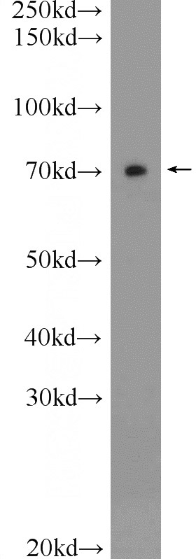 rat brain tissue were subjected to SDS PAGE followed by western blot with Catalog No:116648(Ubiquilin 1 Antibody) at dilution of 1:300