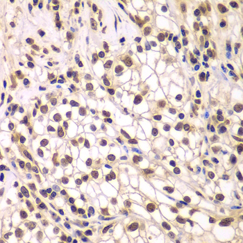 Immunohistochemistry - SMARCC1 Polyclonal Antibody 