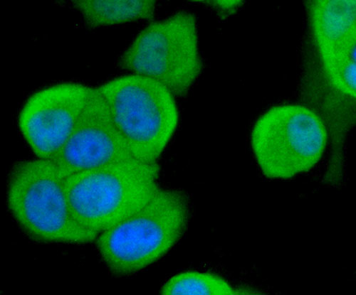 Fig2: ICC staining Osteoprotegerin in MCF-7 cells (green). The nuclear counter stain is DAPI (blue). Cells were fixed in paraformaldehyde, permeabilised with 0.25% Triton X100/PBS.