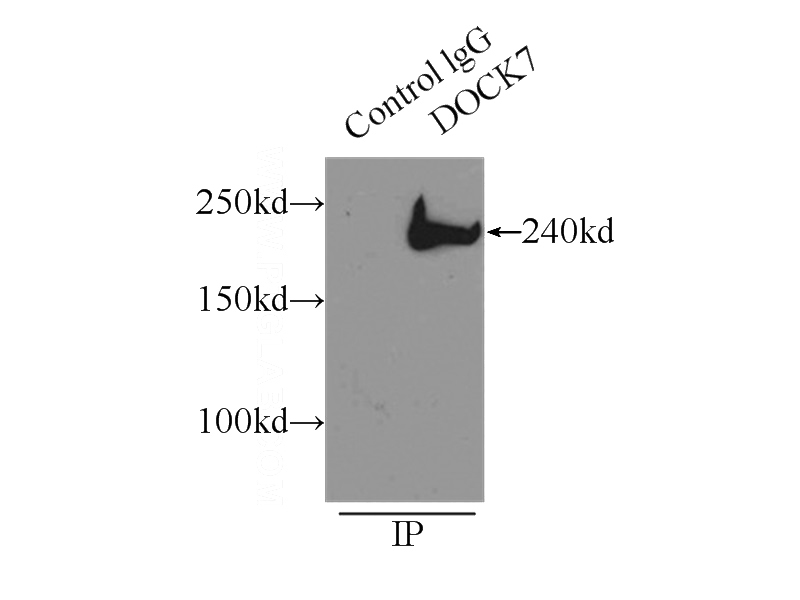 IP Result of anti-DocK7 (IP:Catalog No:110046, 3ug; Detection:Catalog No:110046 1:500) with mouse brain tissue lysate 8000ug.