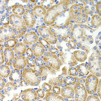 Immunohistochemistry - BMP15 Polyclonal Antibody 