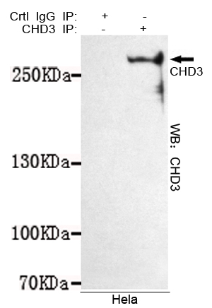 Immunoprecipitation analysis of Hela cell lysates using CHD3 mouse mAb.