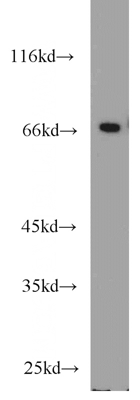 HeLa cells were subjected to SDS PAGE followed by western blot with Catalog No:115049(KHDRBS1 antibody) at dilution of 1:1000