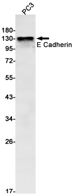 Western blot detection of E Cadherin in PC3 cell lysates using E Cadherin Rabbit mAb(1:1000 diluted).Predicted band size:98kDa.Observed band size:80-120(cleavages),135kDa.