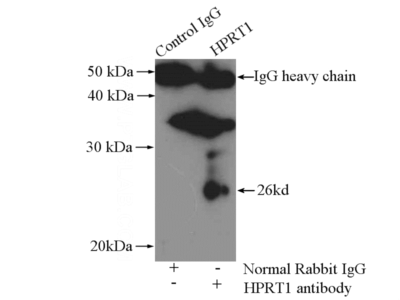 IP Result of anti-HPRT1 (IP:Catalog No:111450, 4ug; Detection:Catalog No:111450 1:1000) with mouse liver tissue lysate 4000ug.