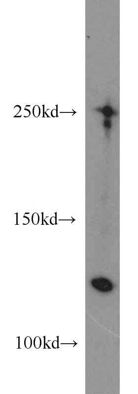 human kidney tissue were subjected to SDS PAGE followed by western blot with Catalog No:109375(COL1A2 antibody) at dilution of 1:500