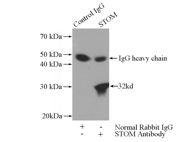 IP Result of anti-STOM (IP:Catalog No:115729, 3ug; Detection:Catalog No:115729 1:300) with HeLa cells lysate 2800ug.