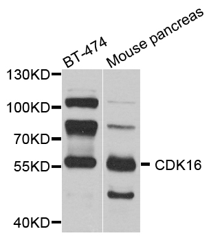 Western blot - CDK16 Polyclonal Antibody 