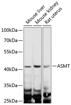 Western blot - ASMT Polyclonal Antibody 