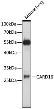 Western blot - CARD16 Polyclonal Antibody 