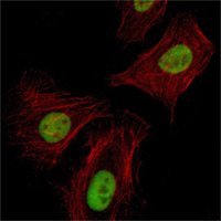 Immunofluorescence analysis of Hela cells using Pirh2 mouse mAb (green). Red: Actin filaments have been labeled with Alexa Fluor-555 phalloidin.