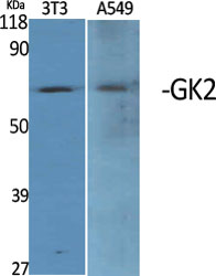 Fig1:; Western Blot analysis of various cells using GK2 Polyclonal Antibody