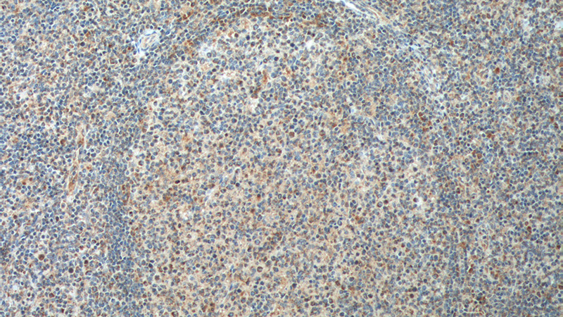 Immunohistochemistry of paraffin-embedded human tonsillitis tissue slide using Catalog No:111133(GPR65 Antibody) at dilution of 1:200 (under 10x lens). heat mediated antigen retrieved with Tris-EDTA buffer(pH9).