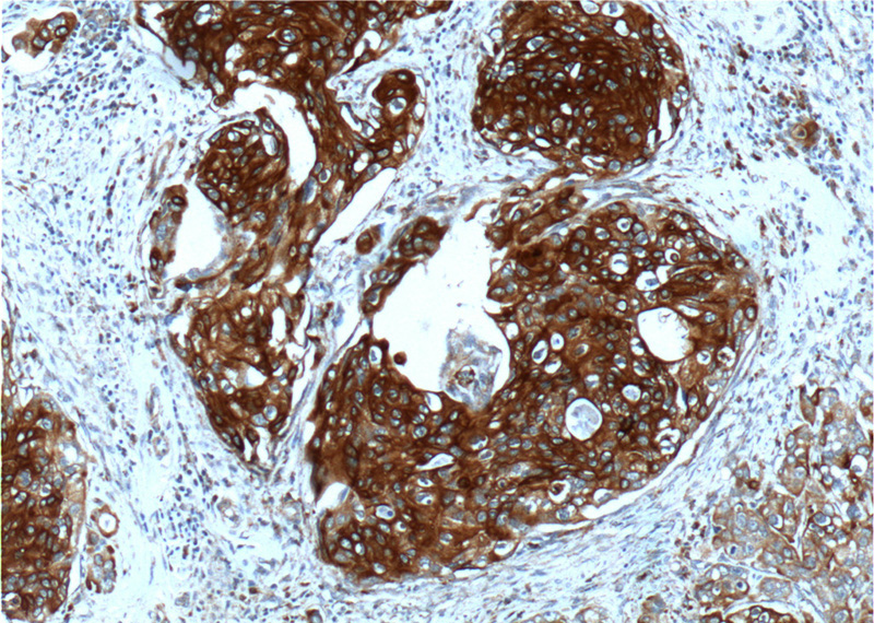 Cytokeratin 13 Rabbit Polyclonal antibody