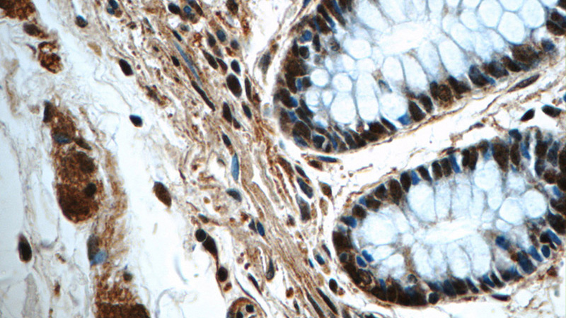 Immunohistochemistry of paraffin-embedded human colon tissue slide using Catalog No:107984(ALKBH1 Antibody) at dilution of 1:50 (under 40x lens)