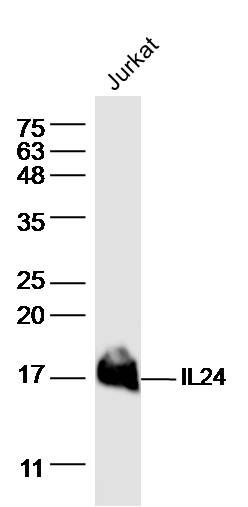Fig1: Sample:; Jurkat (human)cell Lysate at 40 ug; Primary: Anti- IL-24 at 1/300 dilution; Secondary: IRDye800CW Goat Anti-Rabbit IgG at 1/20000 dilution; Predicted band size: 17 kD; Observed band size: 17 kD