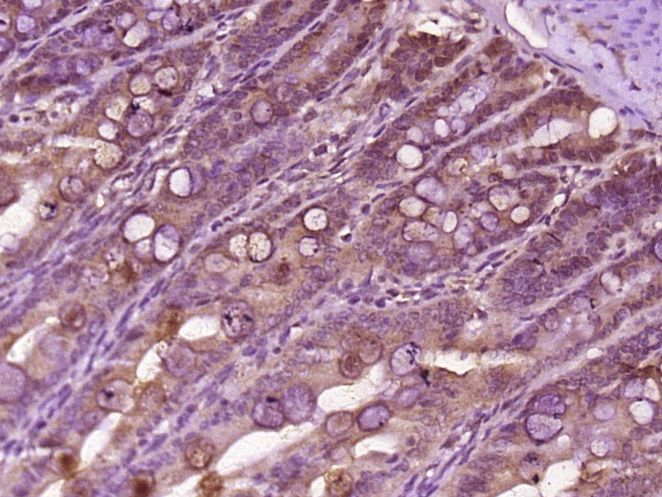 Fig1: Paraformaldehyde-fixed, paraffin embedded (rat colon tissue); Antigen retrieval by boiling in sodium citrate buffer (pH6.0) for 15min; Block endogenous peroxidase by 3% hydrogen peroxide for 20 minutes; Blocking buffer (normal goat serum) at 37℃ for 30min; Antibody incubation with (CENPL) Polyclonal Antibody, Unconjugated at 1:400 overnight at 4℃, followed by operating according to SP Kit(Rabbit) (sp-0023) instructionsand DAB staining.