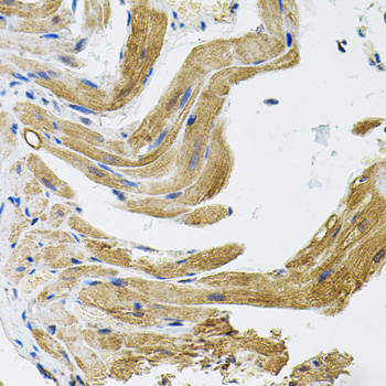 Immunohistochemistry - TRPC1 Polyclonal Antibody 