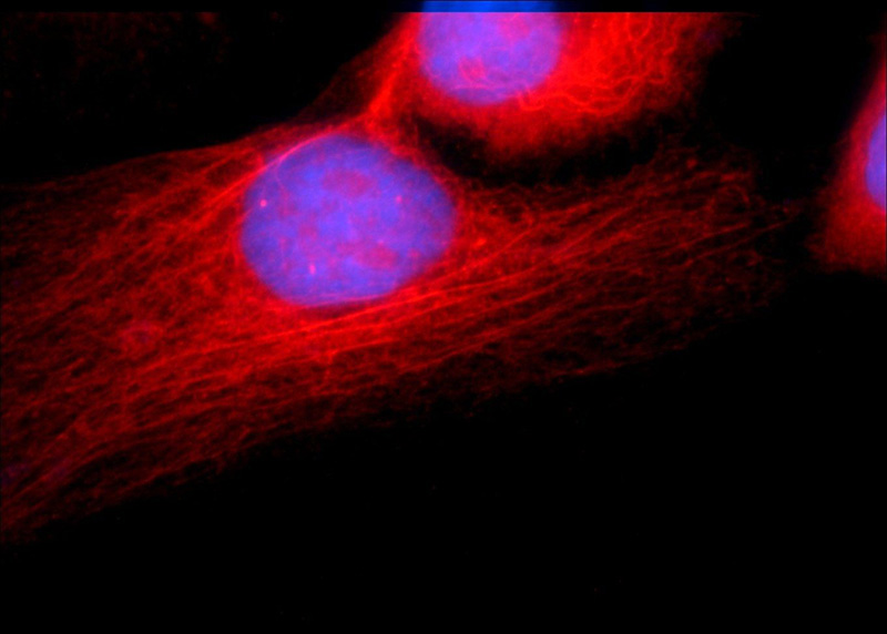 Immunofluorescent analysis of A431 cells using Catalog No:108329(ATGL Antibody) at dilution of 1:25 and Rhodamine-Goat anti-Rabbit IgG