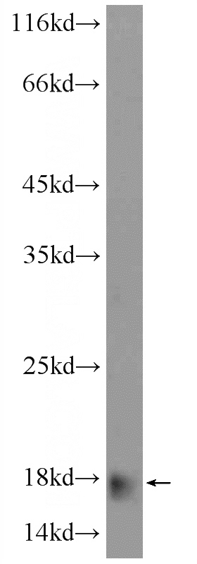 human plasma tissue were subjected to SDS PAGE followed by western blot with Catalog No:108029(APoc4 Antibody) at dilution of 1:300